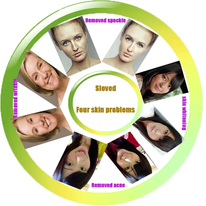 skin whitening advertisement