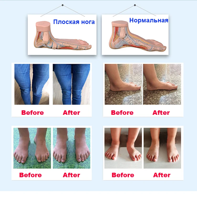 Ortopédicos para Crianças Função de Correção de Alta Qualidade para Meninas e Meninos Botas de Apoio de Tornozelo de Volta Sapatos Alta 25 High Quality Mamãe e Bebê