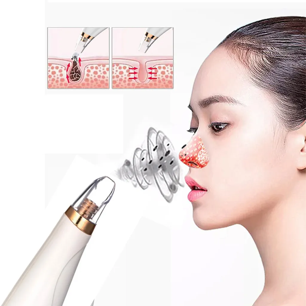

Blackhead Remover Vacuum Facial Acne Pore Cleaner Electronic Come done Blackhead Electric blackhead cleansing instrument