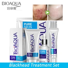 Face-Care-Set Treatment Whitening BIOAQUA Gel 4-Pcs Moisturizing Anti-Acne-Removal Shrink-Pores