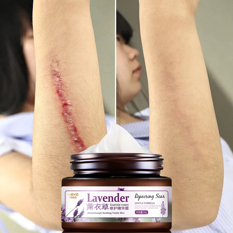 

Lavender Scar Repair Cream Moisturizing Dilute Pigment Remove Scars Pimple Marks Acne Spots Treatment Whitening Skin Care Cream