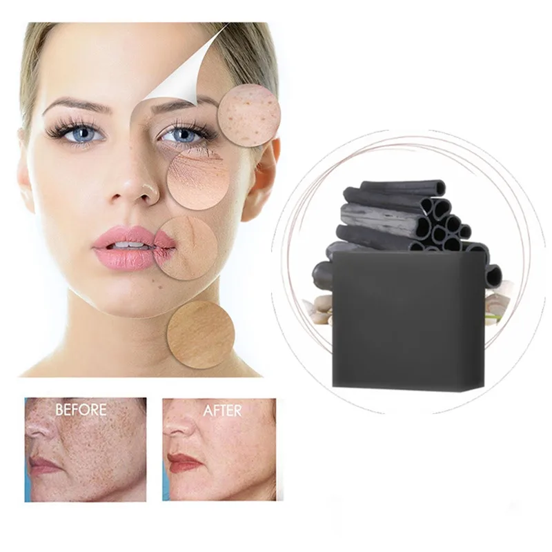 

Eliminate Skin Toxin Whitening Freckle Repair Vitamin Handmade Soap Remove Melasma Pigment Melanin Sunburn Pregnancy Brown Spots