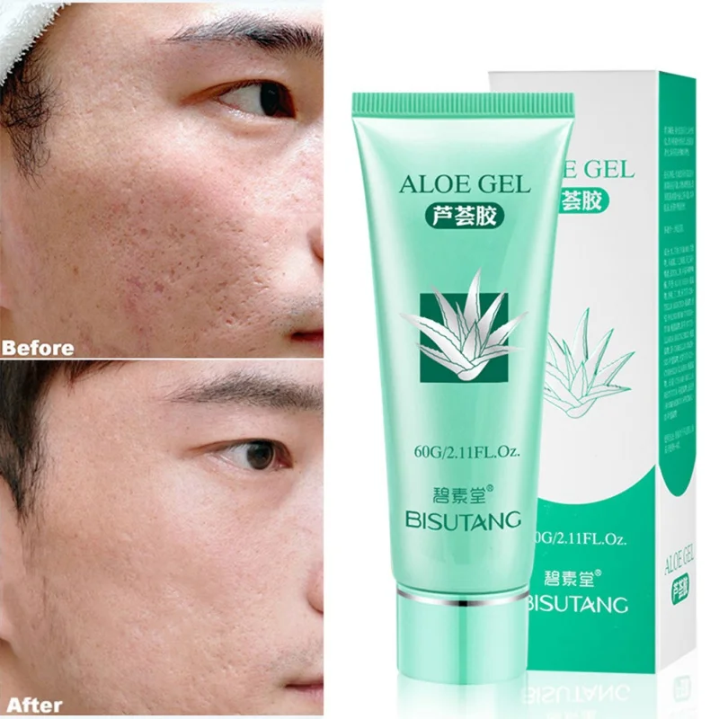 

New Useful aloe vera gel anti wrinkle cream acne scar moisturizer whitening repair drying face skin care product