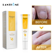 Травяной раствор, анти фонжик, инфекция ногтей, яркий карандаш, против грибкового онихомикоза, крем для восстановления ногтей, Лечение грибка