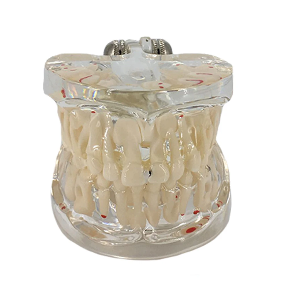 Распавшие зубы модель для детей стандартная прозрачная демонстрационная Стоматологическая модель зубов Модель зубного протеза модель зуба для студентов