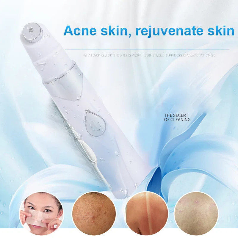 Blue Light Acne Pen Soft Scar Wrinkle Removal Treatment Device for Skin