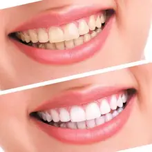2pcs/bag Dental Teeth Whitening Strips Tooth Whitening Strip Tooth Bleaching White Teeth Whitening Strips Daily Life Use TSLM2