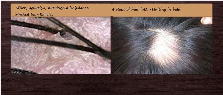 Профессиональный спрей от выпадения волос жидкость для роста волос для женщин и мужчин восстановление волос сухой ремонт волос увлажняющий лечебная сыворотка