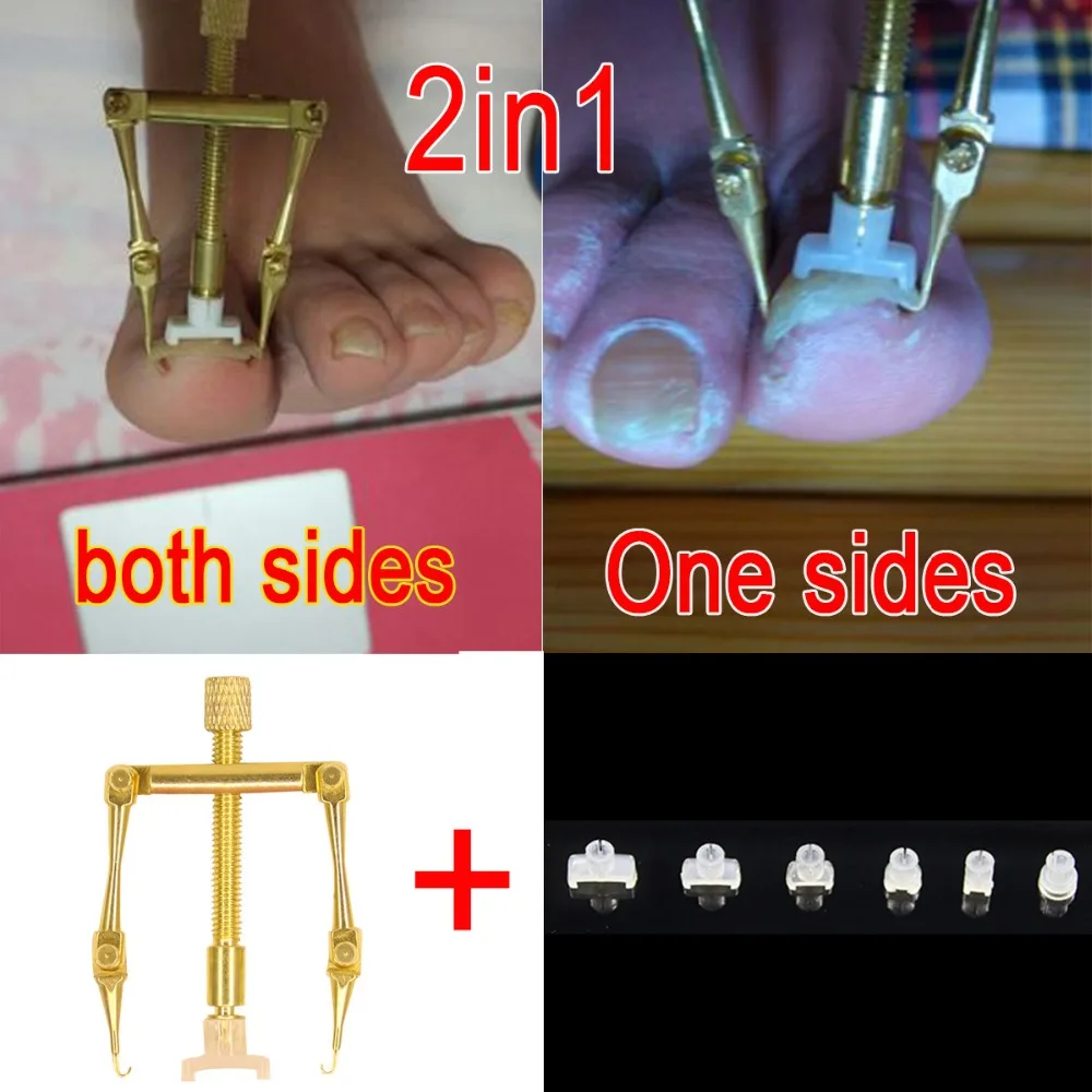 2 в 1 вросших носком коррекция ногтей фиксирующий инструмент для 1 или 2 стороны для вросших ногтей, педикюра инструмент для маникюра Файл Нипер