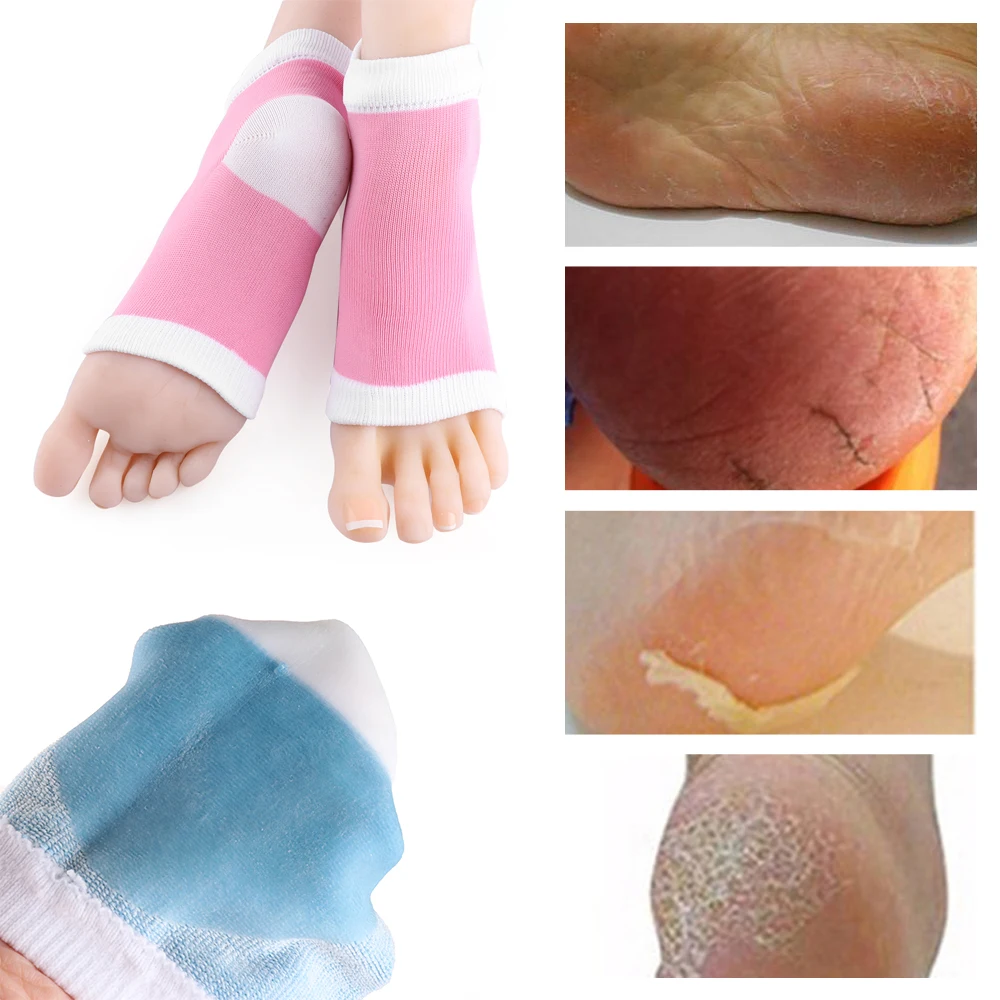 

1 Pair Smooth Silicone Moisturizing Gel Heel Socks Foot Protector Anti Dry Cracked Chapped Foot Skin Care Exfoliating Reusable