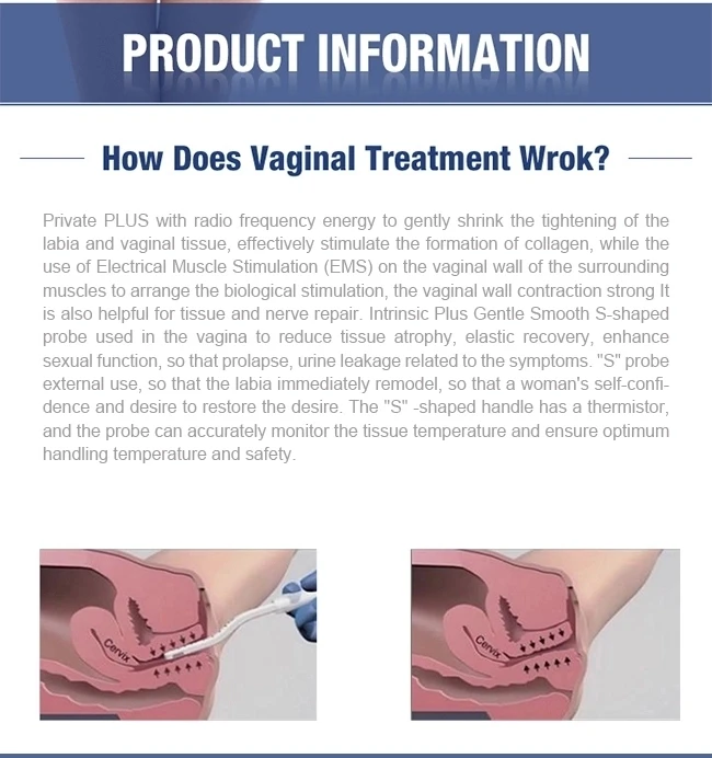 Безопасная ВЧ вагинальная утяжка/портативный прибор для сужения влагалища