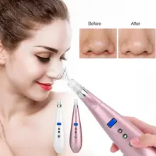 Вакуумный Очиститель пор Электрический угрей головы акне всасывание удаление очищает поры лица Очищение кожи массажер для лица удаление угрей головы
