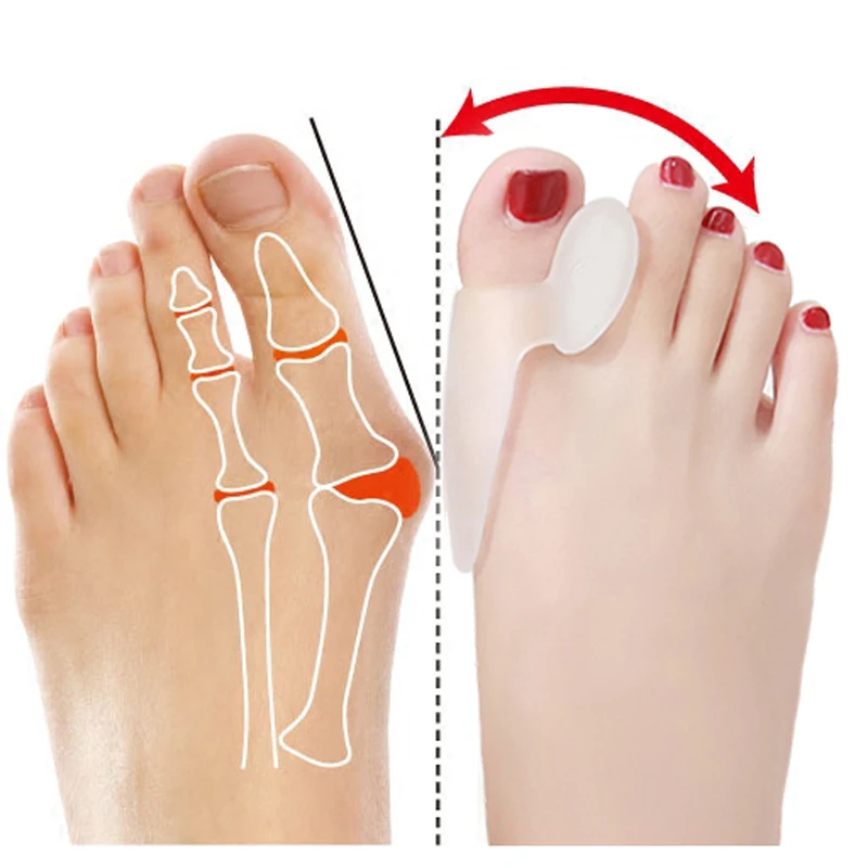 1Pair=2Pcs Gel Silicone Bunion Corrector Big Toe Separators Straightener Spreader Foot Care Tool Hallux Valgus Splint Massager