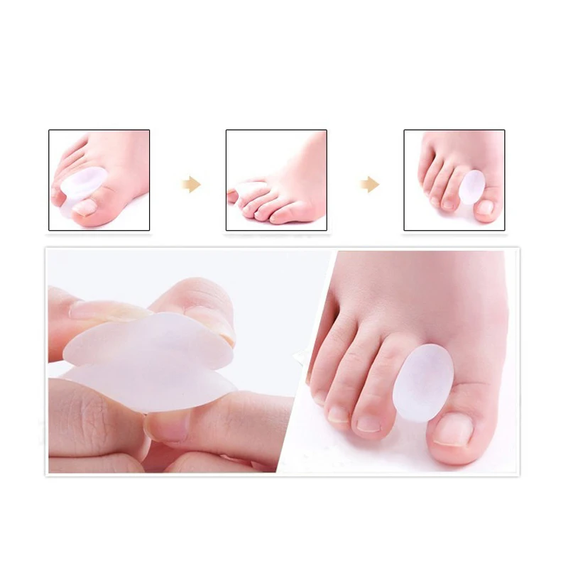 1Pair Bone Thumb Valgus Protector Silicone Foot Finger Toe Separator Bunion Adjuster Hallux Valgus Corrector Pedicure Feet Care
