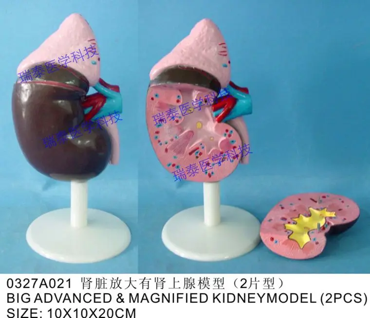 Ampliação Modelo Humano Anatomia Renal Ensino Médico Frete Grátis 2x Rim 6 model kidney