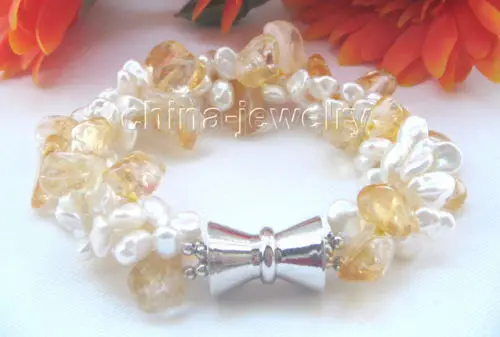 

Beautiful 8" 3row white keshi reborn freshwater pearl & yellow crystal bracelet@^Noble style Natural Fine jewe SHIPPING new >>fr