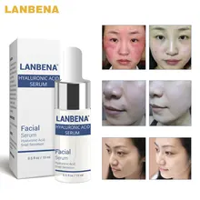 Hyaluronic Acid Essence Serum Acne Treatment Skin Care Whitening Cream Face Anti Winkles Ageless Moisturizing Snail Essence Oil