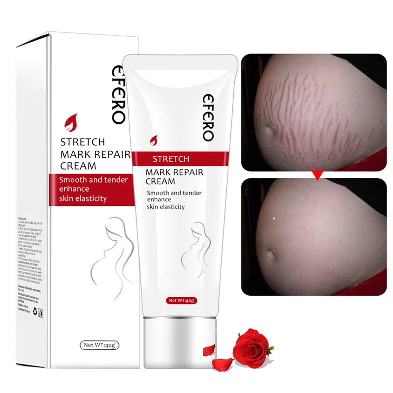 

Stretch Mark Repair Cream Remover Removal Scar Body Skin Care for Pregnancy Women NShopping