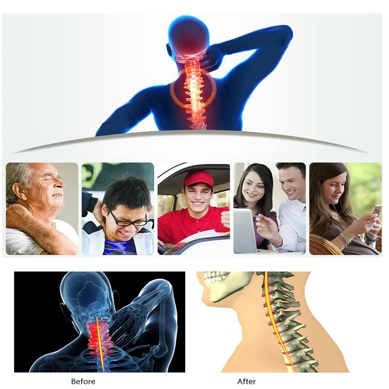 Шейный Тяговый пояс шейный Тяговый прибор шейный растягиватель для шеи хиропрактический Корректор осанки голова спина Расслабление здоровья