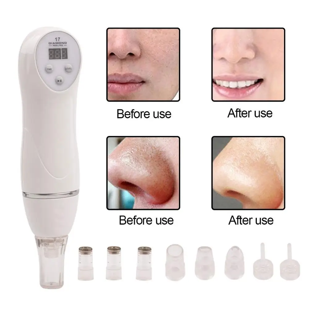 diamond peeling machine (8)