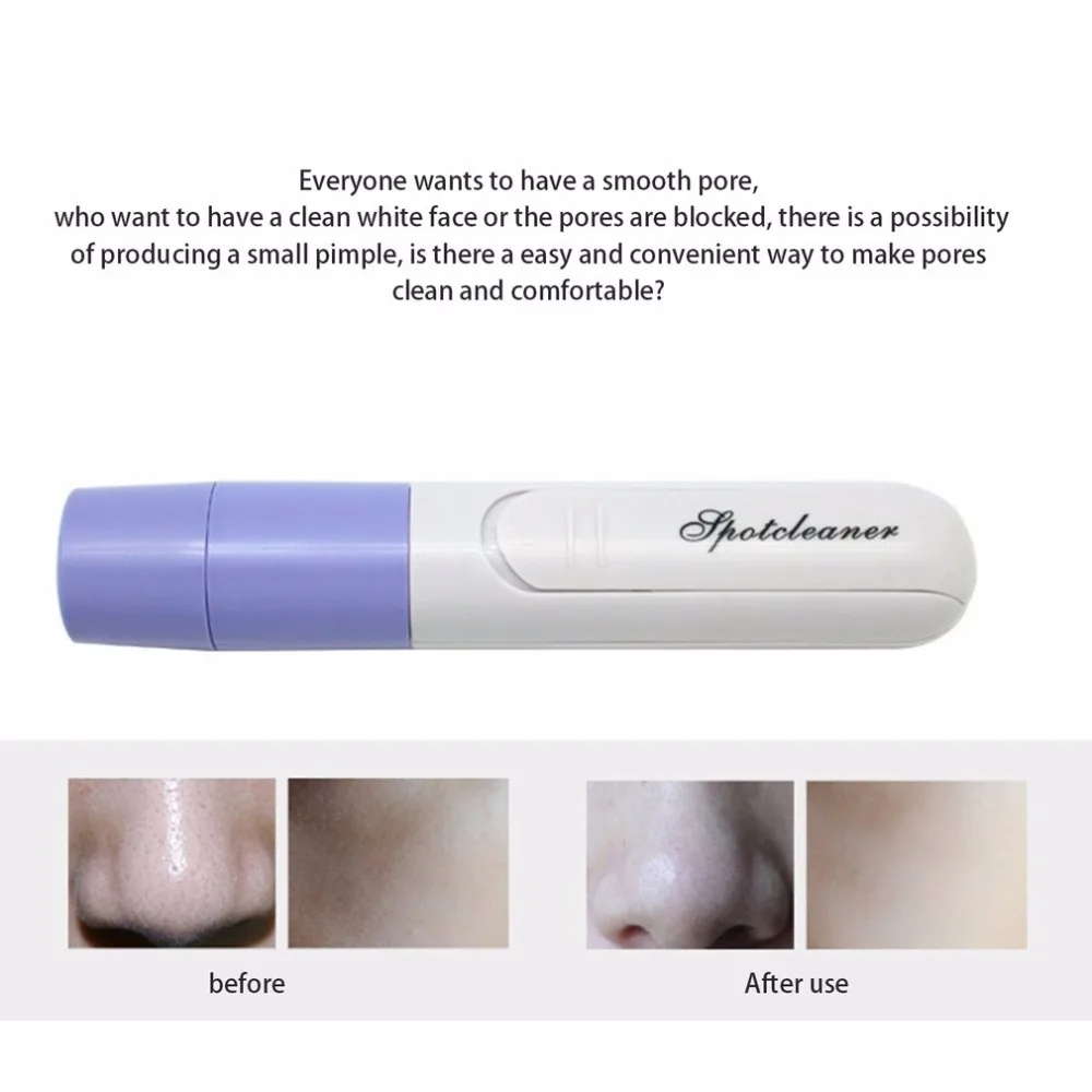 Harga Fashion Mini Portable Komedo Remover Alat Vacuum Extractor Jerawat Hisap Exfoliating Pori Pembersih Kecantikan Instrumen