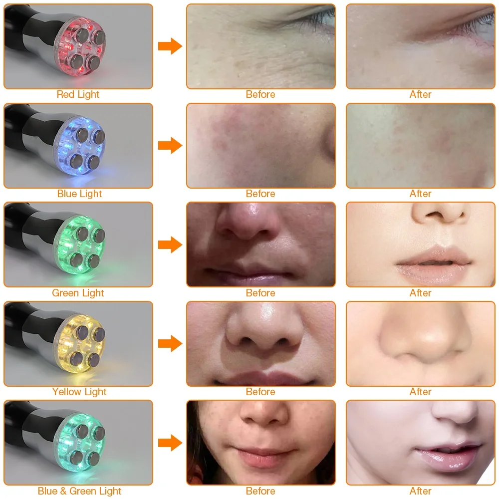 RF Радио Частота Красота терапия массажер тела и лица светодиодный фотон мезотерапия машина для ухода за кожей красота машина для подтяжки лица