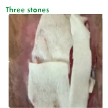 2X2 дюймов выживания высокая целостность альгинат кальция волокна стерильные мягкие и очень абсорбирующие одевания