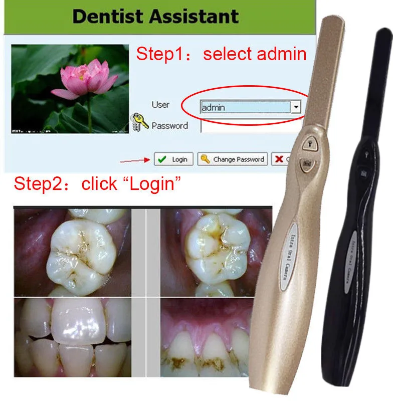 

Dynamic 1.3 Mega Pixels 6-LED Intraoral Intra Oral Camera USB Software best US 2 colors to choice