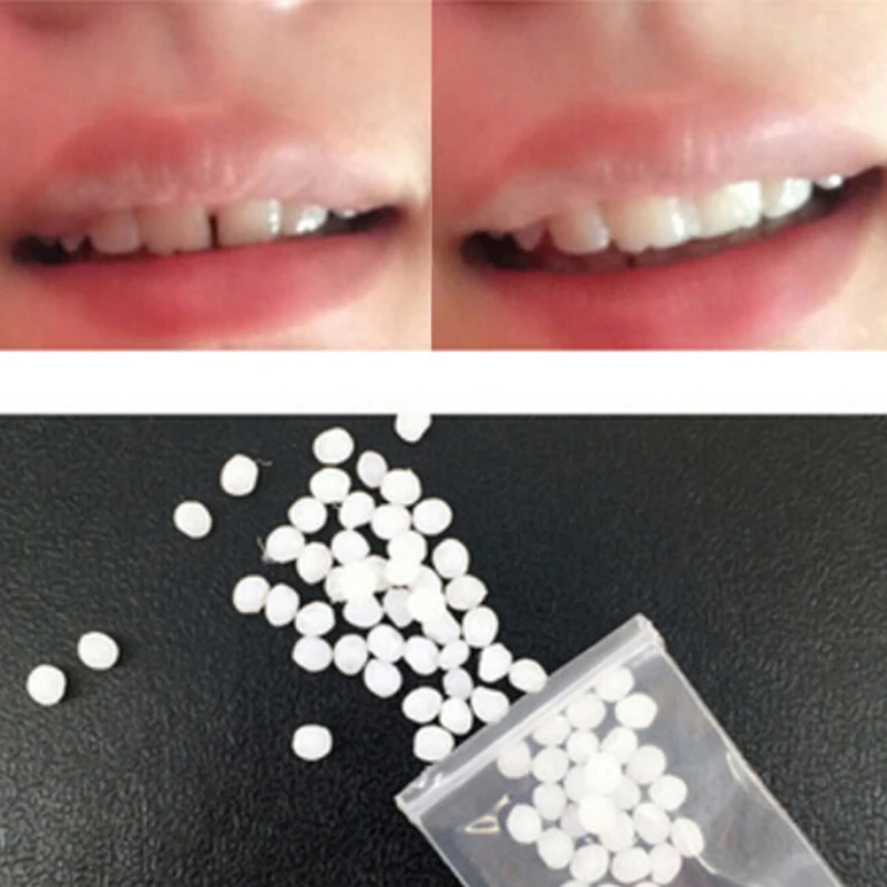 5g Смола FalseTeeth твердый клей Временный набор для ремонта зубов зубы и зазор Falseteeth твердый клей протез клей зубной Стоматолог
