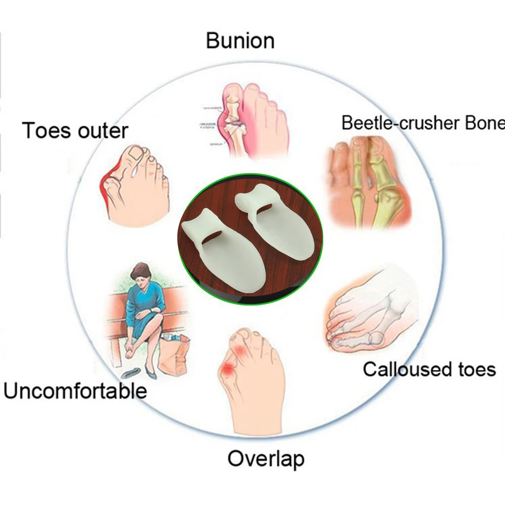 2 шт. силиконовый гель защиты Корректор Бурсит большого пальца стопы сепаратор перекрытие разбрасыватель вальгусной стопы Средства ухода