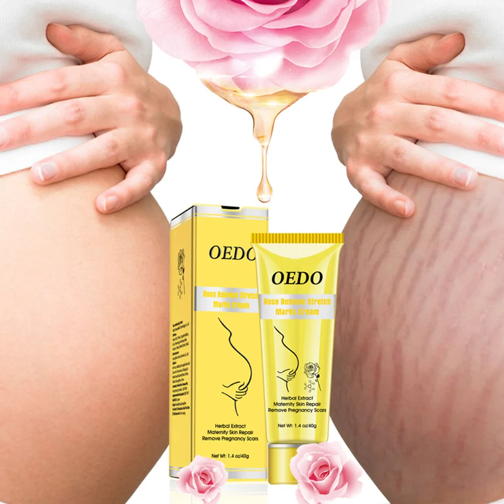 1 шт средство для удаления растяжек крем для гладкой уход за кожей крем для Удаления растяжек для беременных Slackline для беременных