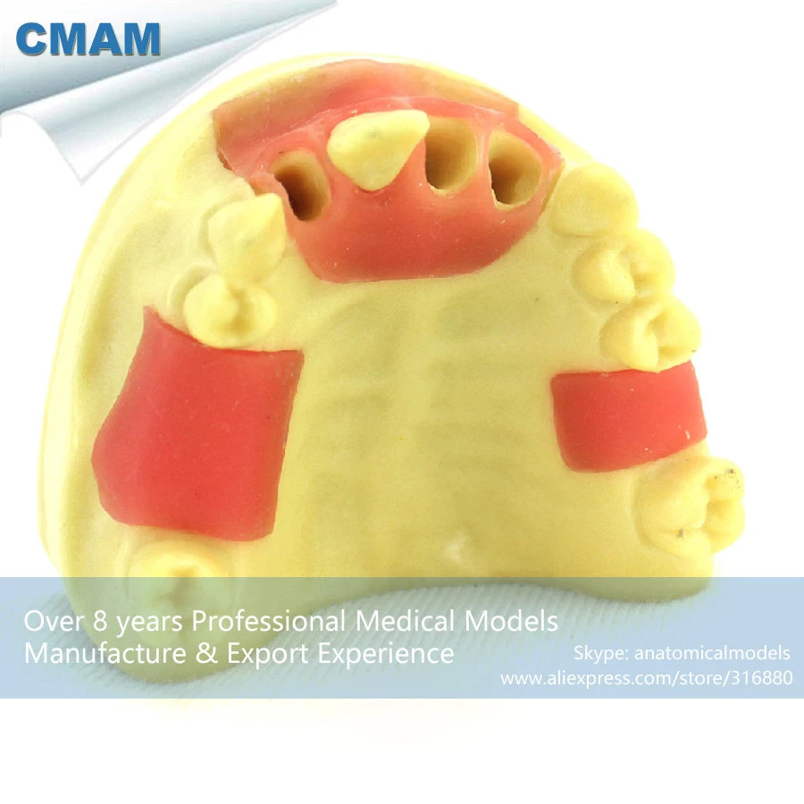 

12620 / CMAM-IMPLANT09 Maxillary Implantation Practice Jaw Model, Medical Science Educational Teaching Anatomical Models