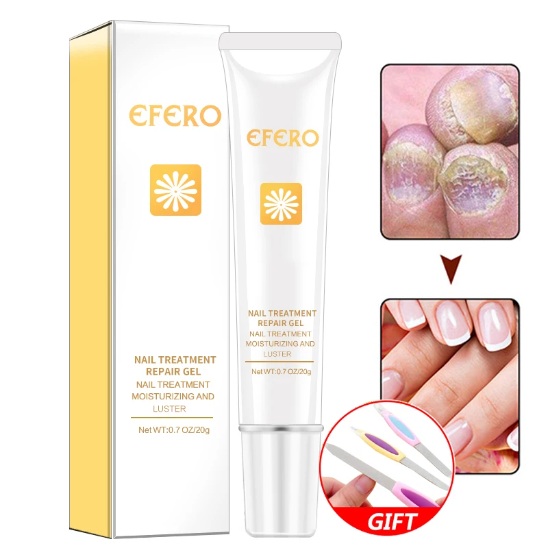 

Fungal Nail Treatment Essence Nail Foot Whitening Toe Nail Fungus Removal Feet Care Nail Anti Infection Paronychia Onychomycosi