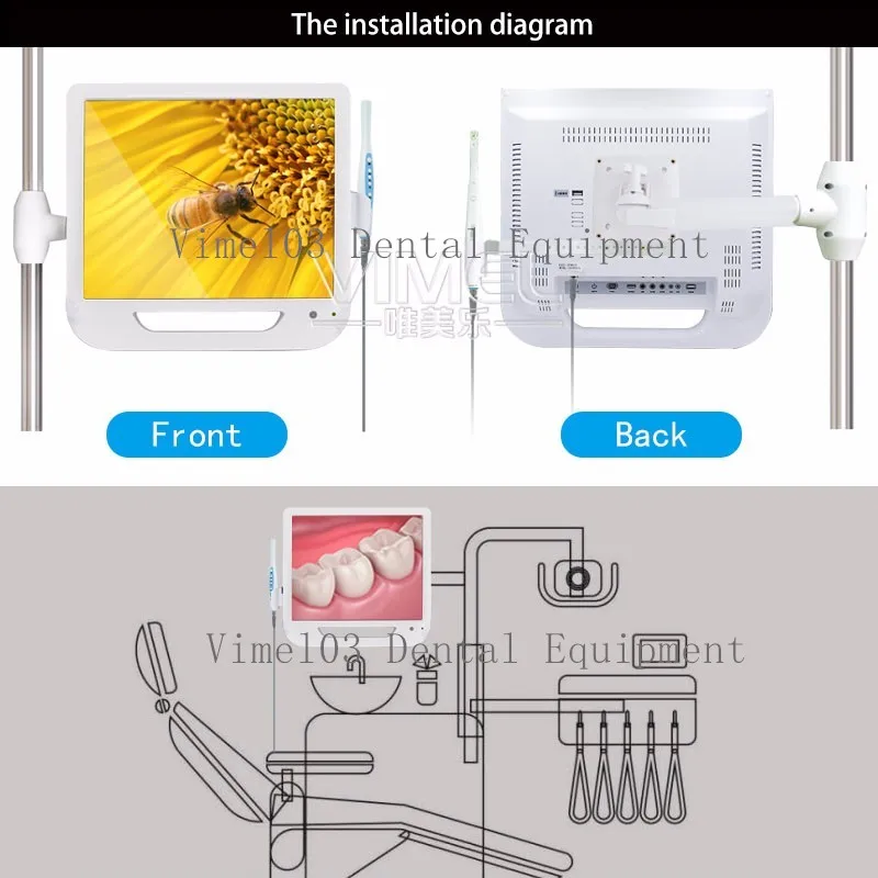 Все в одном полости рта Камера Системы 300 мега пикселей 17 дюймов ЖК-дисплей для контроля уровня сахара в крови с usb стоматологический эндоскоп с ЖК-дисплей держатель