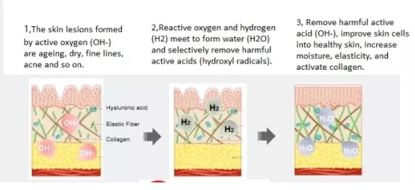 Корея 4в1 H2O2 водород маленький пузырьковый аппарат для омоложения кожи лица