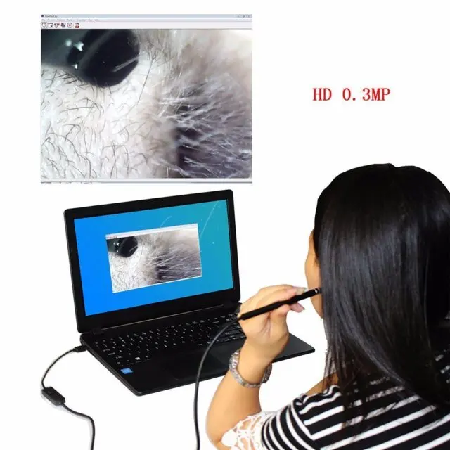 2-в-1 USB многофункциональный эндоскопа бороскоп для очистки уха, носовой полости и горло проверки с уха выборка