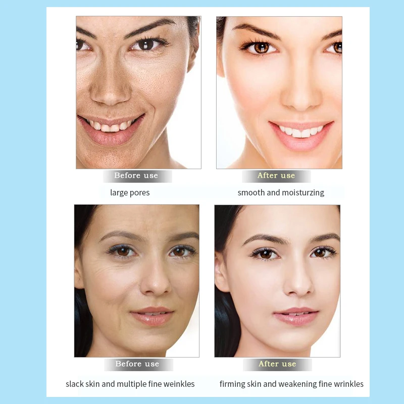 Anti-Oxidation Brighten Face Cream Shrink Pores Hyaluronic Acid Moisturizer Cream Anti Aging Eye Cream Dark Circles Eye Massager