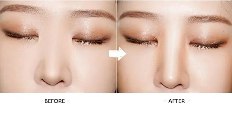 Shadow Powder Repaired Horns Big Forehead Repair Capacity Powder