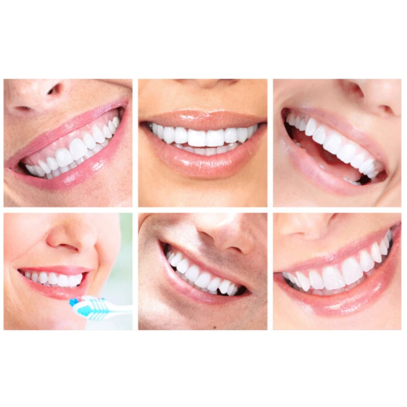 

Hot Teeth Peroxide Dental Bleaching System Oral Gel Kit Tooth Dental