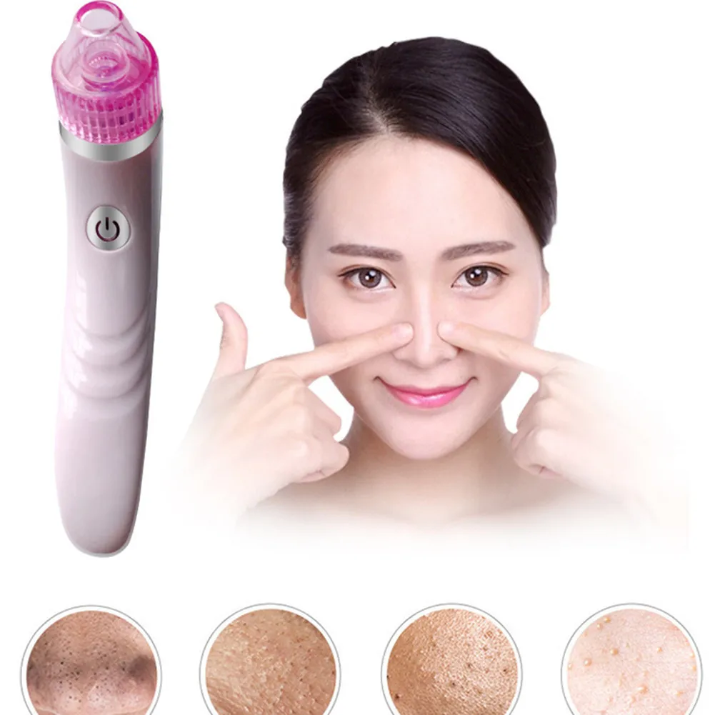 Electronic Facial Pore Cleaner Nose Blackhead Cleansing Acne Remover