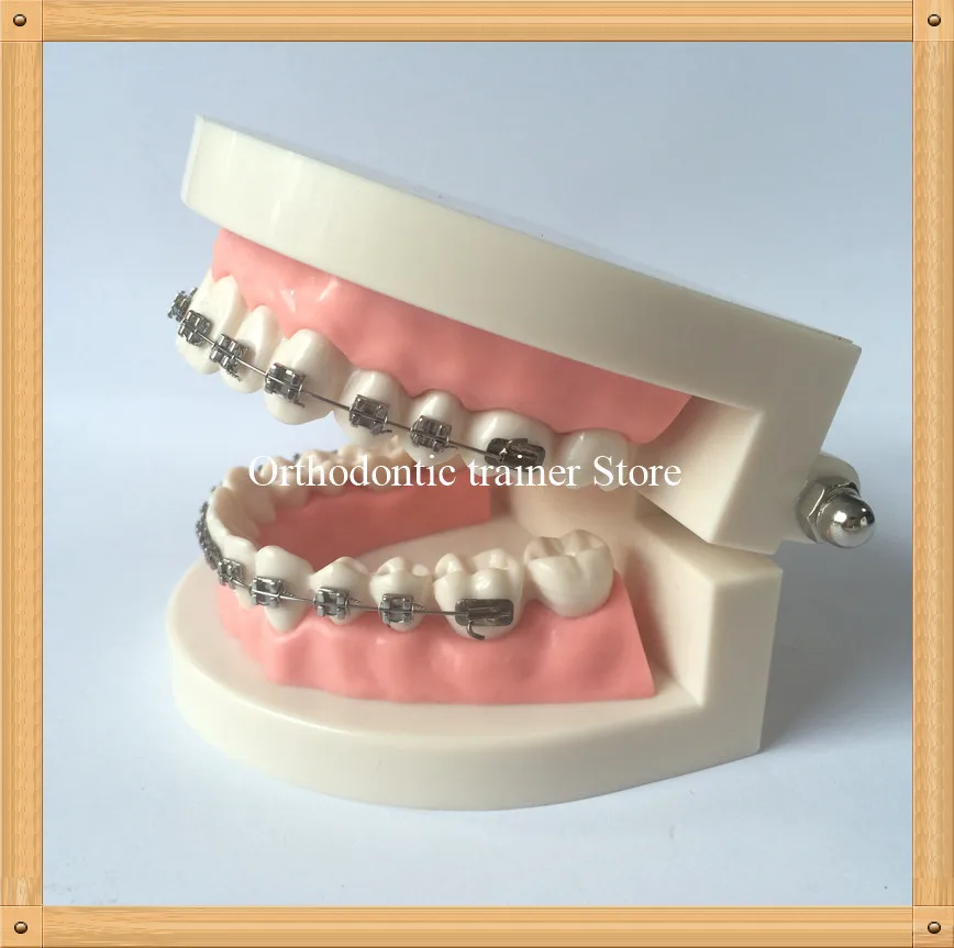 Orthodontic teeth model-3