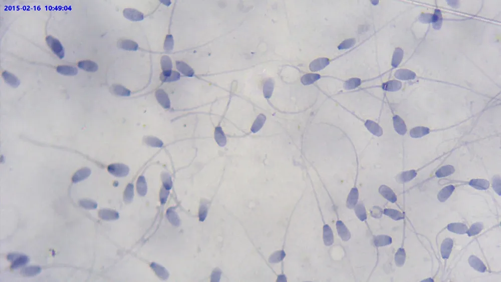99_Rabbit_Sperm_Smear