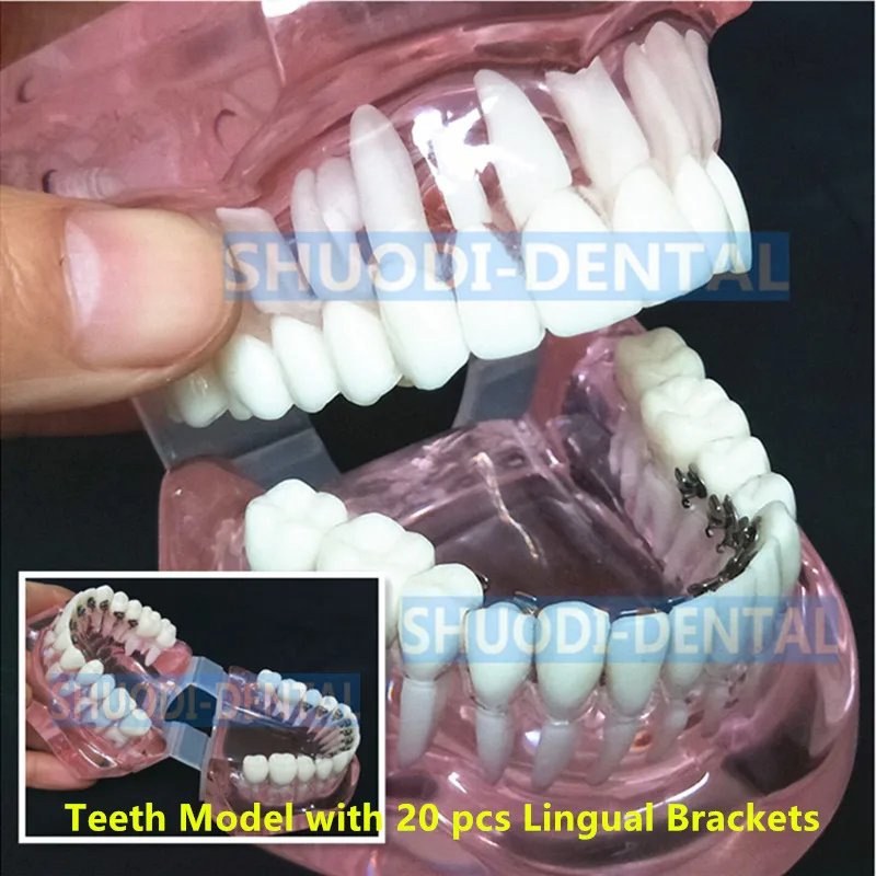 Стоматологическая Ортодонтическая модель с языковыми кронштейнами для стоматолога-Исследования связи пациента прозрачная модель зуба