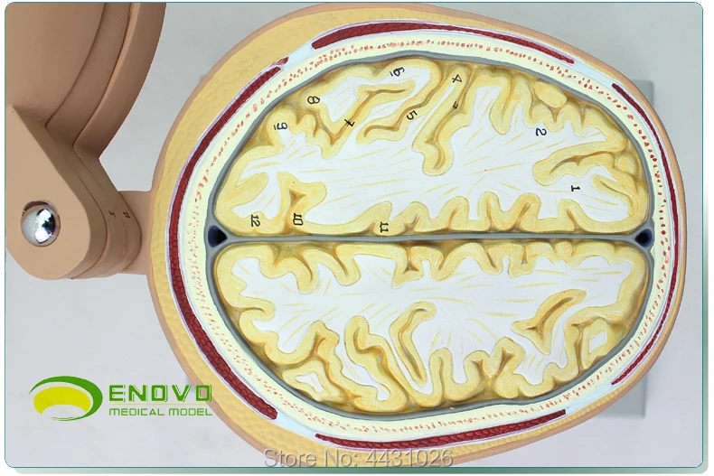 Эново мозговая трансекционная модель в медицине человека. Мозговой КТ МРТ мозговой магнитно-резонансной томографии