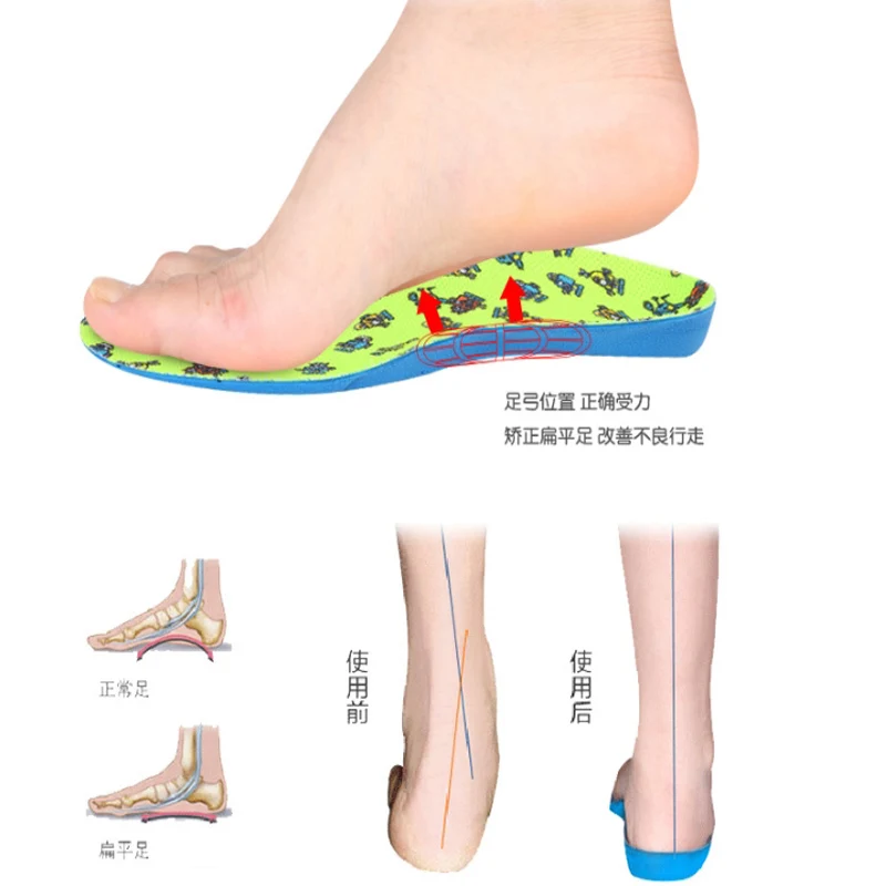 the best arch support for flat feet
