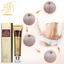 LANBENA Cream Acne Scar Removal creme Face Cream Skin Repair Spots Acne Treatment Blackhead Whitening Cream Stretch Marks 30ml LANBENA Cream Acne Scar Removal creme Face Cream Skin Repair Spots Acne Treatment Blackhead Whitening Cream Stretch Marks 30ml