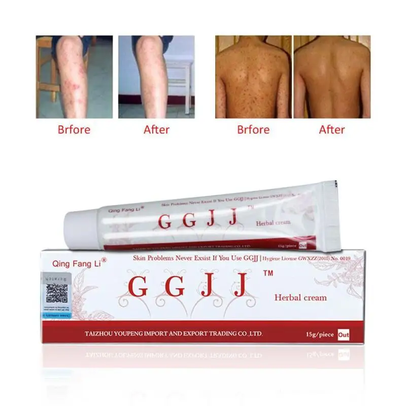 Antipruritic Eczema Psoriasis Cream and Dermatitis Therapy Ointments