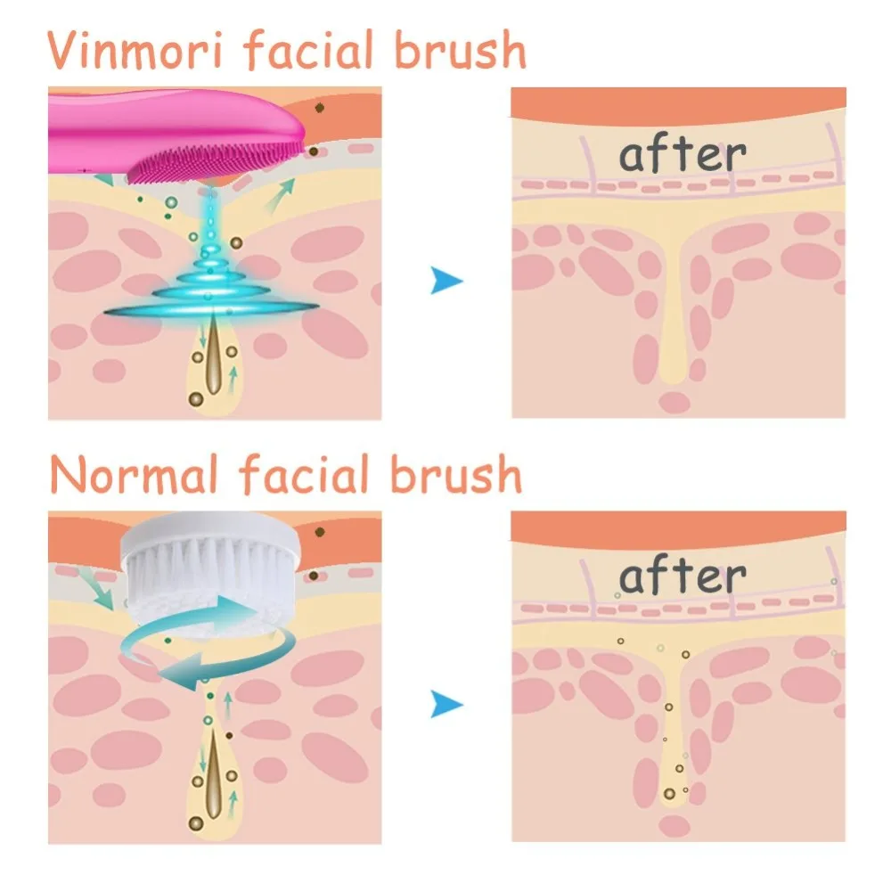 Беспроводная ультра звуковая Очищающая щетка для лица, щетка для лица, 12 Скоростей для глубокого очищения пор, против старения