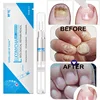 Nail Fungus Repair Treatment Pen Products Onychomycosis Paronychia Anti Fungal Nail Chinese Herbal Care Oil Pen TSLM1 ► Photo 1/6