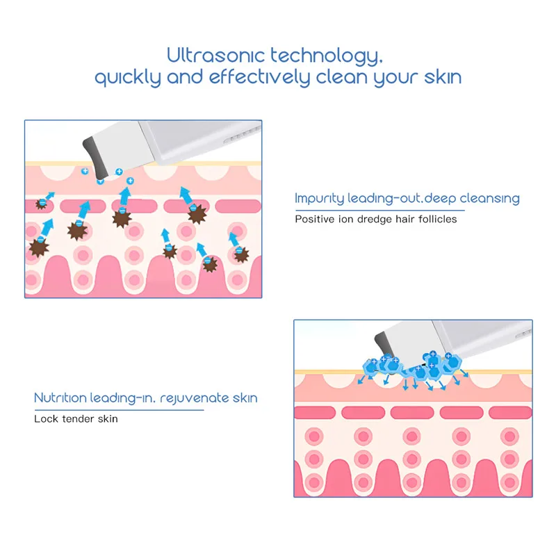 USB Rechargeable Ultrasonic Vibration Skin Scrubber Face Skin Peeling Extractor Acne Blackhead Remove Exfoliating Scraper Shovel